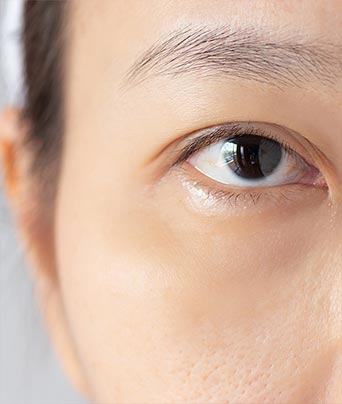 Eyelid Health