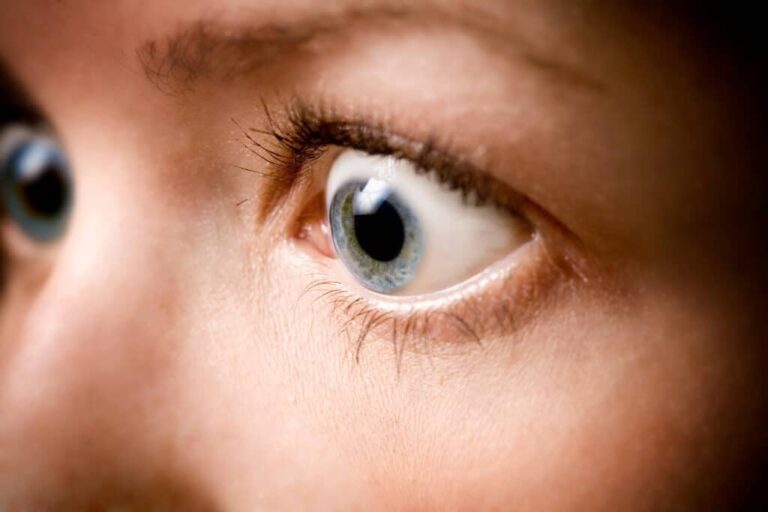 When Eyes Bulge: Exploring the Causes and Concerns of Proptosis