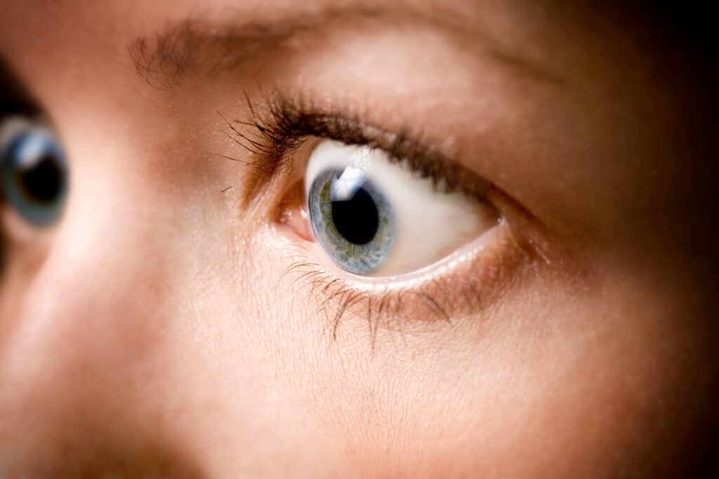When Eyes Bulge: Exploring the Causes and Concerns of Proptosis